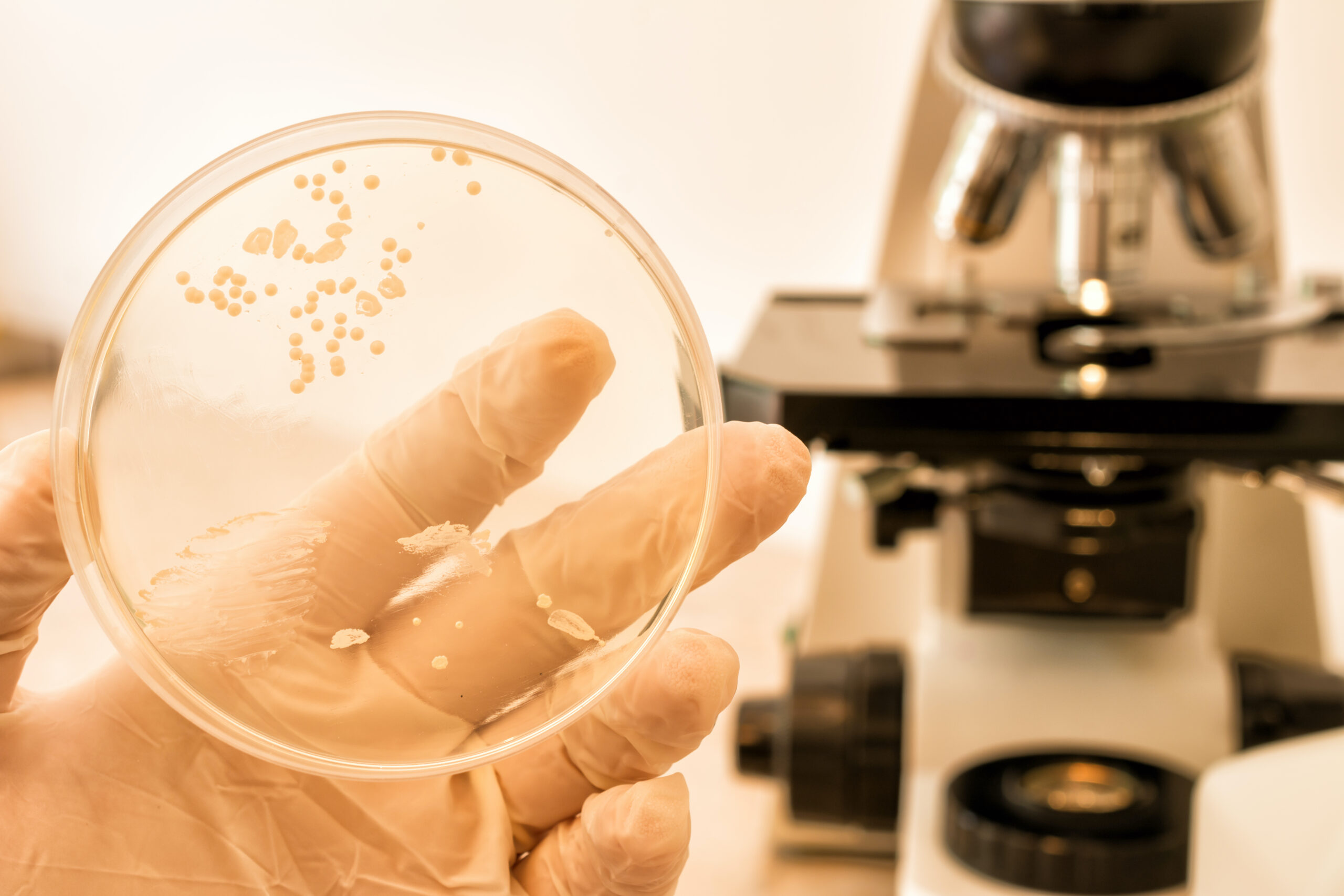 Return of the Yeast Issue